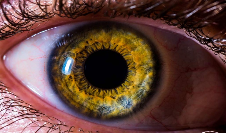 Difference entre la retine et liris